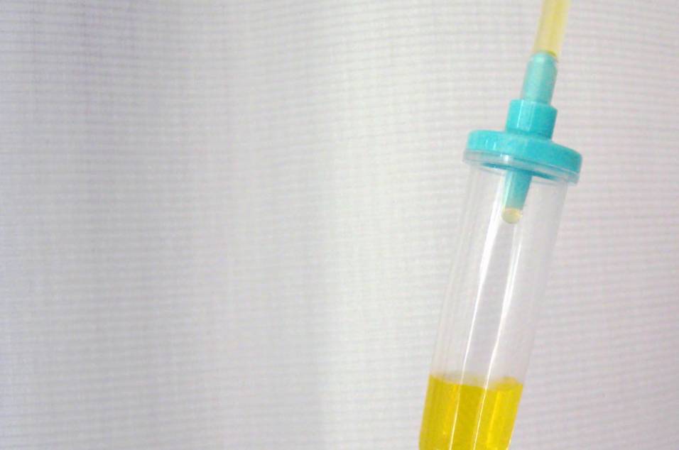 岩手県北上市立花・及川脳神経内科クリニック・ふるえの治療